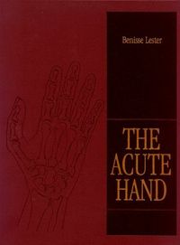 Acute hand