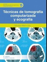 Tecnicas de tomografia computerizada y ecografia 2ª ed
