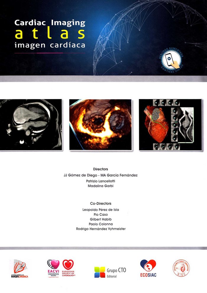 Atlas de Imagen Cardíaca-Cardiac Imaging Atlas