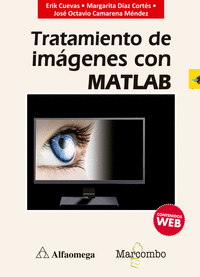 Tratamiento de imágenes con MATLAB