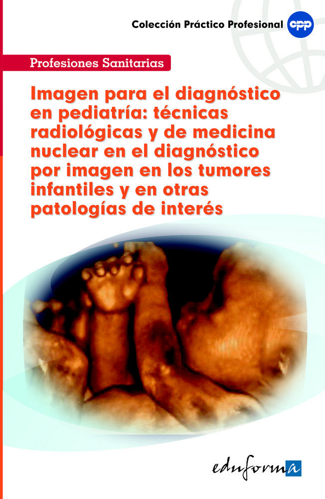 Imagen para el diagnóstico en pediatría: técnicas radiológicas y de medicina nuclear en el  diagnóstico por imagen en los tumores infantiles y en otras patologí
