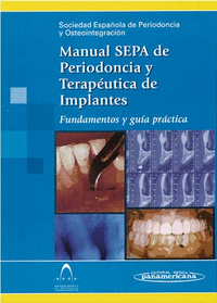 SEPA:Manual Periodoncia y  Osteointegr.