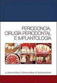 Periodoncia, cirug¡a periodontal e implantolog¡a