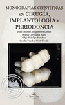 Monograf¡as cient¡ficas en cirug¡a, implantolog¡a y periodoncia