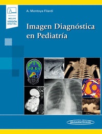 Imagen diagnostica en pediatria (incluye version digital)