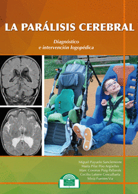 Paralisis cerebral diagnostico e intervencion logopedic