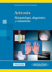 Artrosis, fisiopatolo¿gia, diagnostico y tratamiento