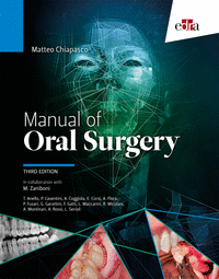 Manual of oral surgery 3'ed