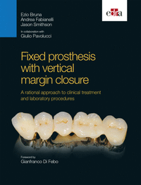Fixed prosthesis with vertical margin closure