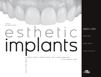 Esthetic implants how to think about complex cases in anteri